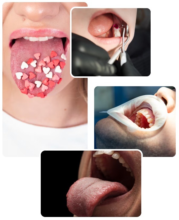 Oral Cavity Cancer Signs and Symptoms