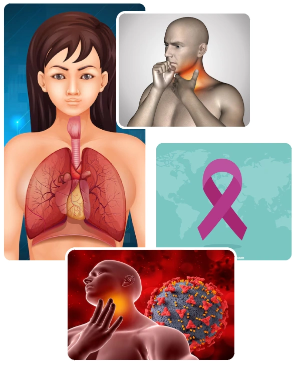 Treatment of Oropharynx Cancer