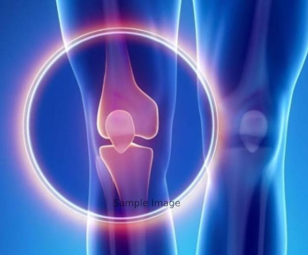 Osteosarcoma 