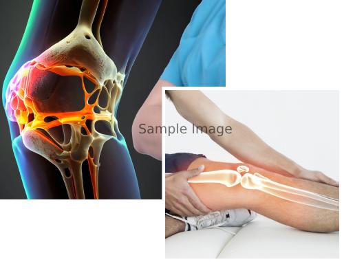 Causes of Bone Cancer