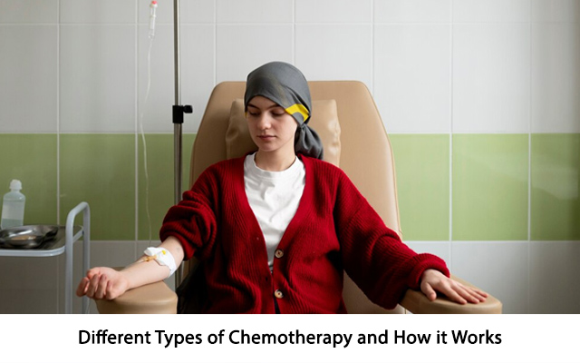 Different Types of Chemotherapy and How It Works