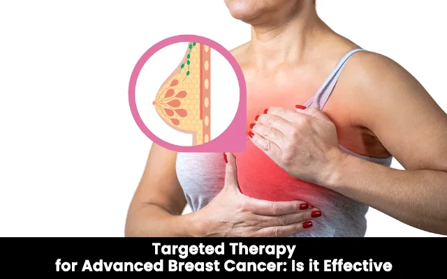 Targeted Therapy for Advanced Breast Cancer: Is it Effective