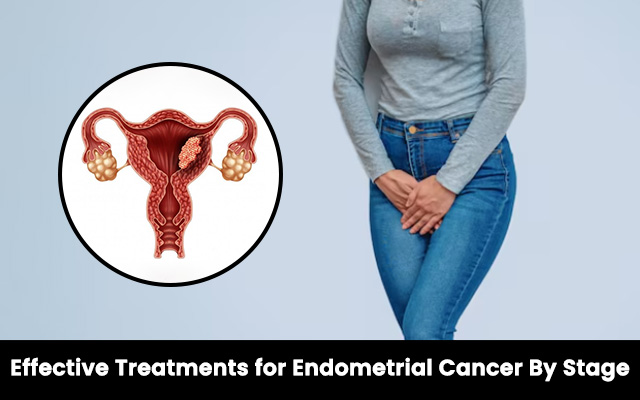 Effective Treatments for Endometrial Cancer by Stage
