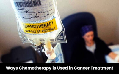 Ways Chemotherapy is Used in Cancer Treatment