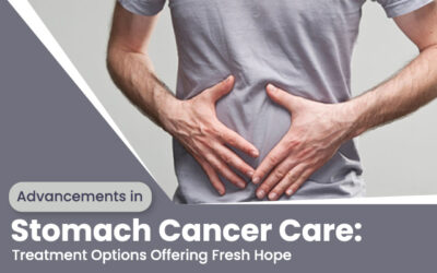 Advancements in Stomach Cancer Care: Treatment Options Offering Fresh Hope